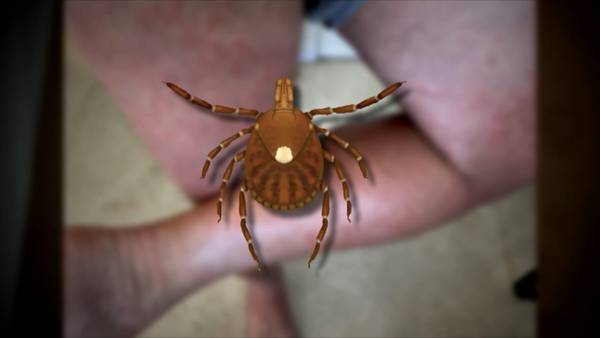 Bite from Lone Star tick can lead to life-changing allergic reaction