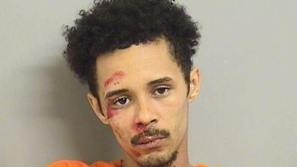 Robbery suspect escapes police car, attempts to run, but tumbles face-first into curb